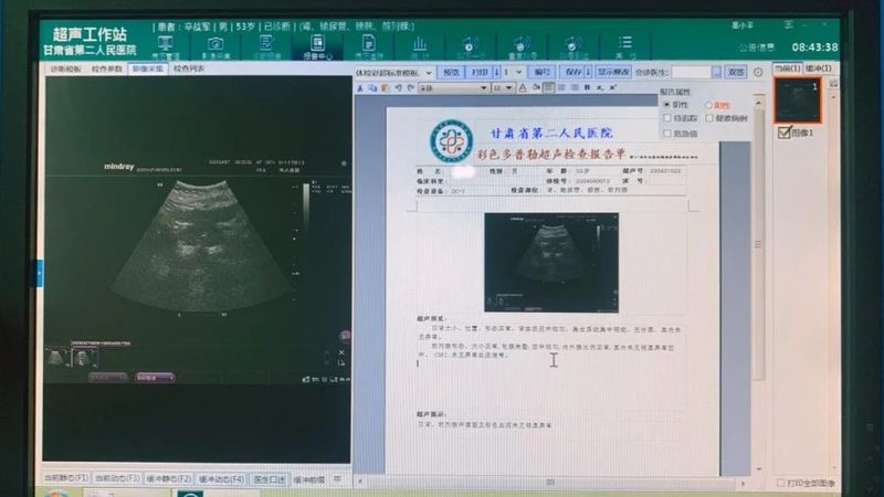 高端体检加盟：揭秘加盟流程与关键步骤**